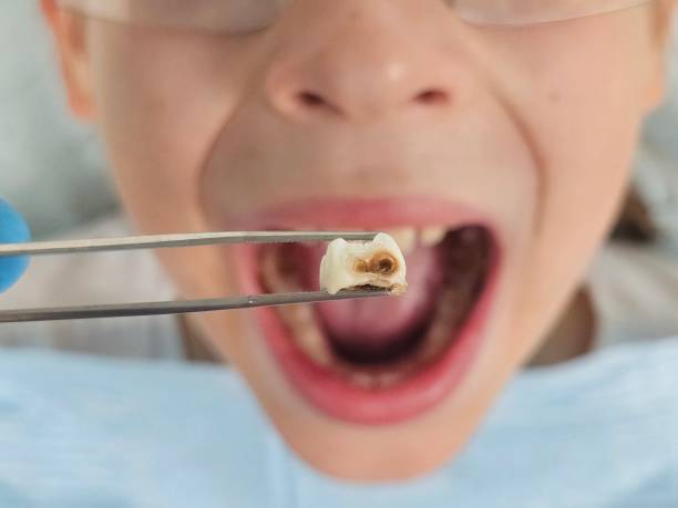 Best Pediatric Emergency Dentist in Bothell West, WA